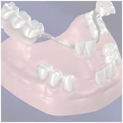 Dentures